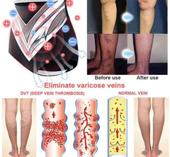 Titanium Fibre Tourmaline Shaping Shorts